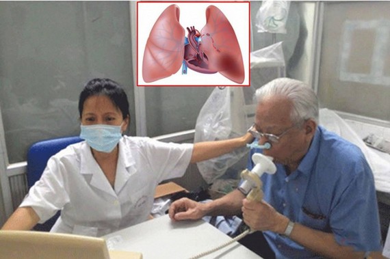 在越南，40歲以上的人患慢性阻塞肺病的比例是4.1%。患病人數有繼續增加的趨勢。（示意圖源：互聯網）