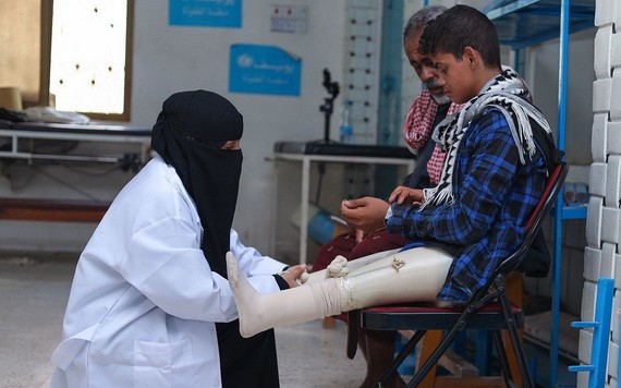 也門亞丁一家醫院的醫生正在檢查一名小男孩的假肢。（圖源：UNICEF） 