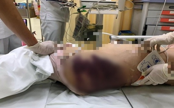 8歲女童在送達醫院前已死亡，身上多處瘀傷疑似受虐。（圖：院方提供）