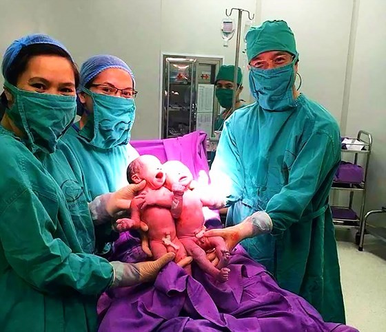 Các bác sĩ Bệnh viện Sản Nhi Quảng Ninh đón 2 trẻ sinh đôi bằng phương pháp thụ tinh trong ống nghiệm