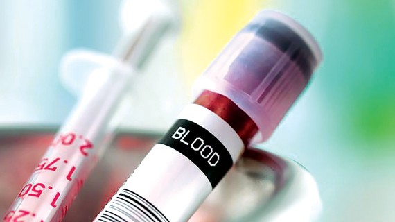 Tầm soát ung thư bằng xét nghiệm máu