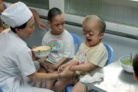 A staff member of the Hoa Binh-Tu Du Village takes care of AO/dioxin child victims (Source: VNA)
