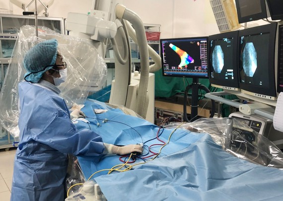 Bác sĩ đang sử dụng phương pháp triệt đốt điện sinh lý cho bệnh nhân