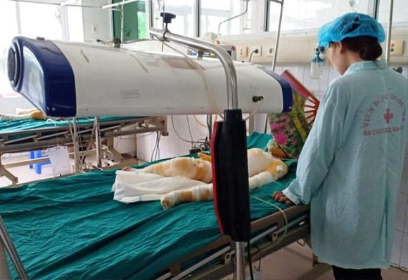 Vụ dạy 'kỹ năng sống' khiến 3 trẻ bỏng nặng: Công an làm rõ trách nhiệm những người liên quan ảnh 2