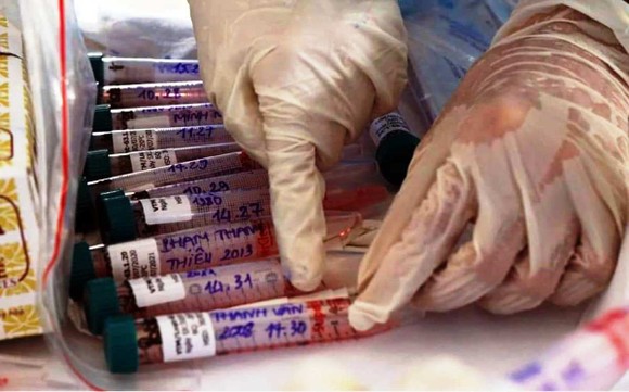 Sáng nay 4-5, Đà Nẵng, Hà Nội, An Giang có 4 ca mắc Covid-19, Bộ Y tế thông báo khẩn ảnh 1