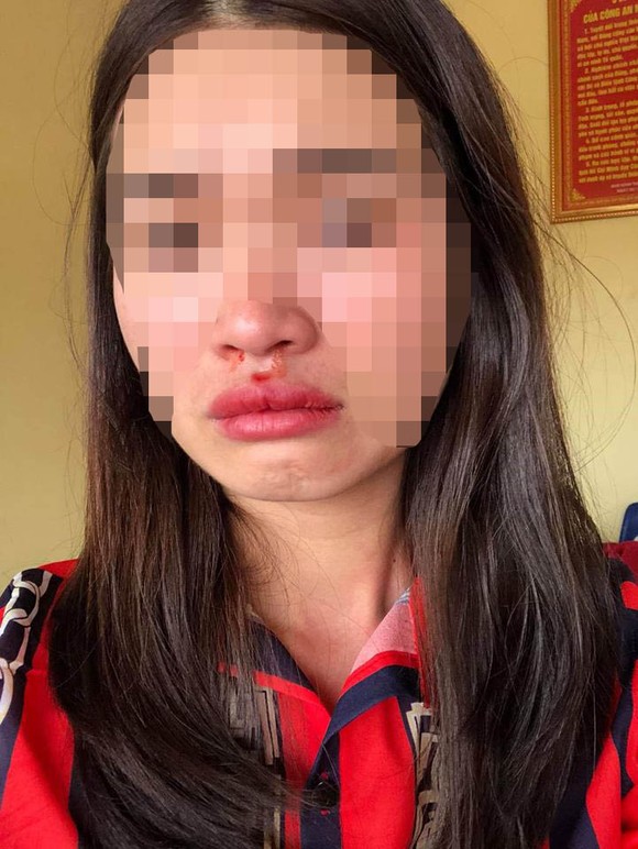 Nữ hành khách tố bị nhân viên nhà xe hành hung dã man ảnh 1