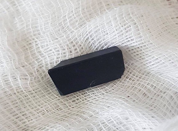 Nội soi, lấy thành công nút bấm điều khiển ti vi dài 1,5cm nằm trong khí quản bệnh nhi 3 tuổi ảnh 1