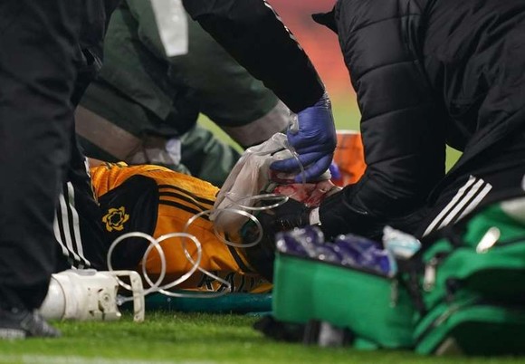Raul Jimenez bị nứt sọ sau pha cụng đầu kinh hoàng với David Luiz ảnh 1