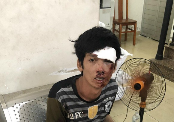 Bắt tên cướp đẩy người xuống kênh cướp tài sản ảnh 1