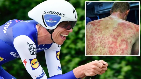 Criterium du Dauphine: Mưa đá bất ngờ ở chặng 2, một số tay đua sưng hết mình mẩy ảnh 1