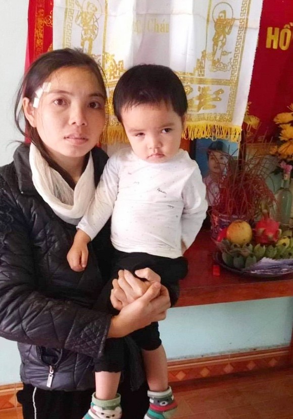 Bé gái 2 tuổi mong được cứu đôi mắt ảnh 1