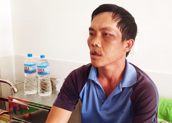 Người của chủ đầu tư dự án điện mặt trời bắt dân trói, hành hung, phơi nắng? ảnh 1