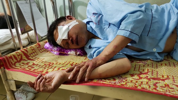 Khai phun thuốc diệt muỗi nhưng bị đánh vì nghi bắt cóc trẻ em ảnh 1