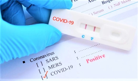 Quảng Ngãi mua kit test của Công ty Việt Á hơn 5 tỷ đồng ảnh 1