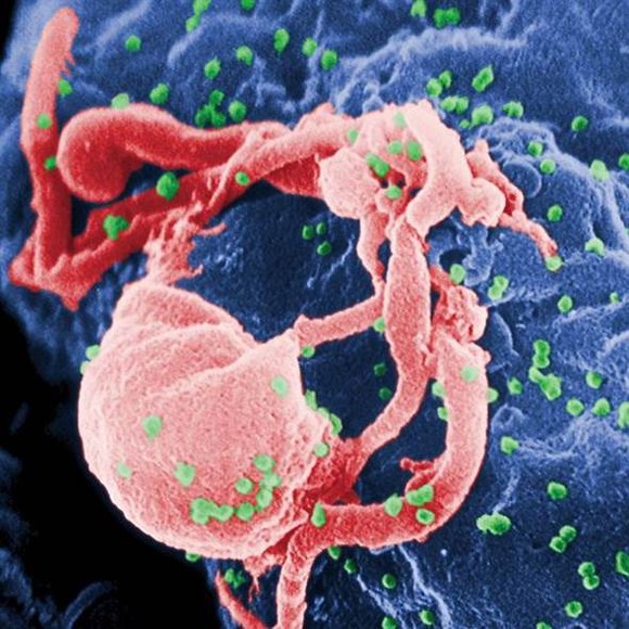 HIV病毒的顯微照相。(圖源：美國疾病管制局)