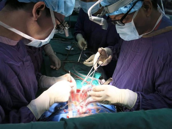 Bác sĩ Việt Nam lập kỷ lục về ghép 23 tạng thành công ảnh 1