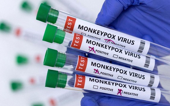 Việt Nam ráo riết chuẩn bị vaccine, thuốc điều trị đậu mùa khỉ ảnh 1