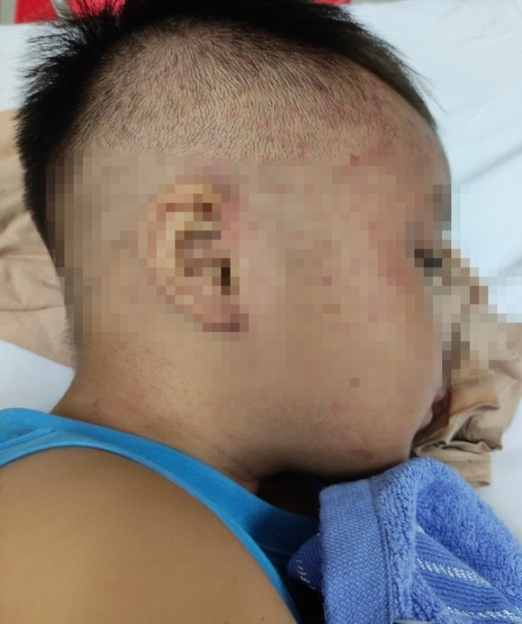 Cấp cứu kịp thời bé trai 4 tuổi bị bạo hành nhét vào tủ đông ảnh 1
