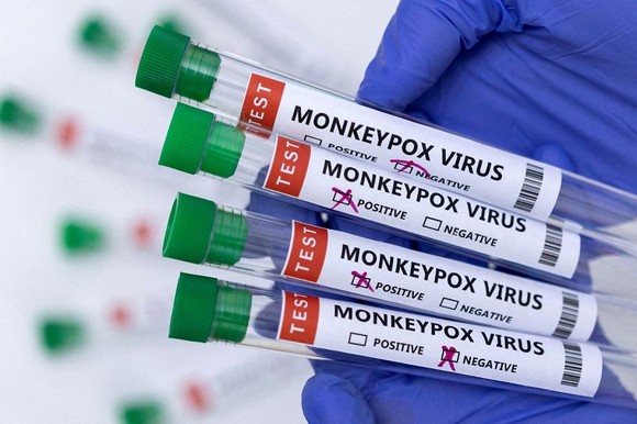 Có nên tiêm vaccine đậu mùa khỉ sau khi Việt Nam đã có ca mắc? ảnh 1