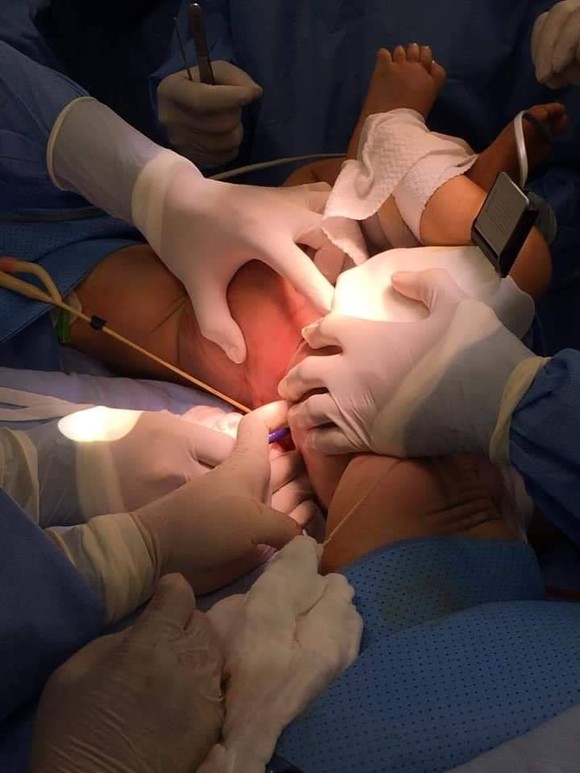 Trúc Nhi - Diệu Nhi được đưa ra khỏi phòng mổ ảnh 5