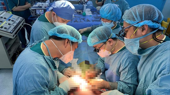 Các bác sĩ thực hiện ca phẫu thuật. Ảnh: www.hcmcpv.org.vn
