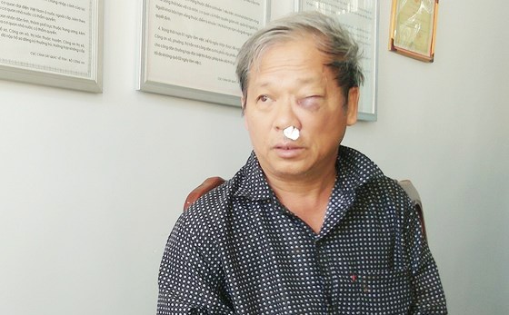 Chủ tịch UBND tỉnh Kon Tum chỉ đạo điều tra vụ phóng viên VTV bị hành hung dã man ảnh 2