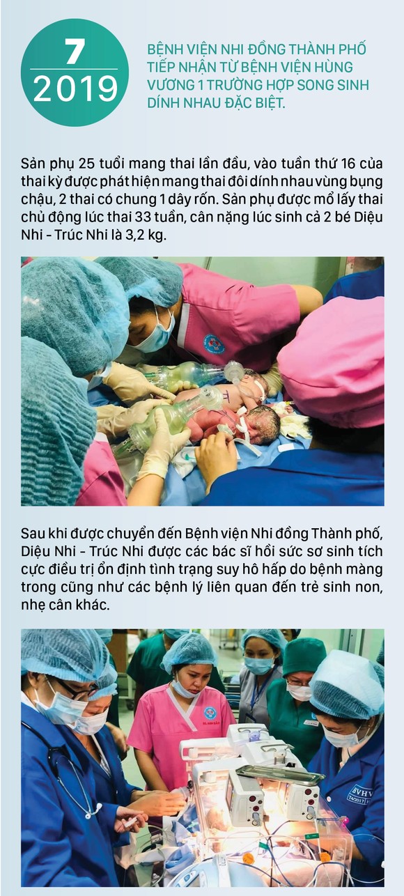 Hành trình của cặp song sinh dính liền hiếm gặp nhất Việt Nam Diệu Nhi - Trúc Nhi ảnh 1