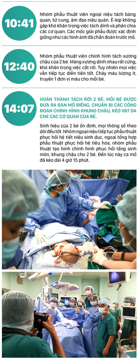 Hành trình của cặp song sinh dính liền hiếm gặp nhất Việt Nam Diệu Nhi - Trúc Nhi ảnh 15