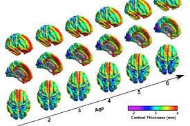 新“腦圖“精確定位動物大腦意識