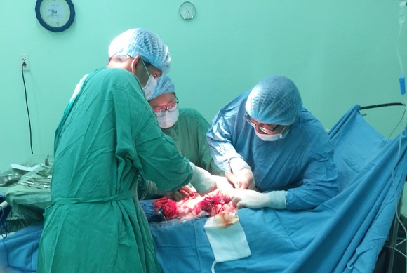 Phẫu thuật thành công khối u xơ tử cung nặng gần 6kg ảnh 2