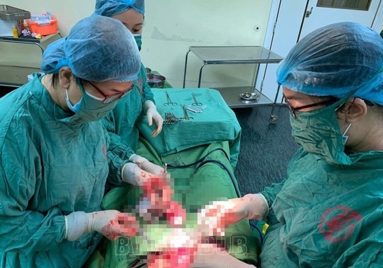 Vietnamese doctors conduct operation on woman with two wombs carrying twin in each ảnh 1